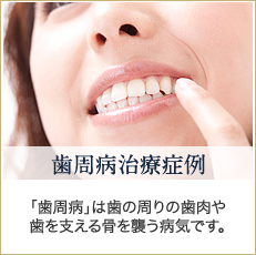 歯周病治療症例